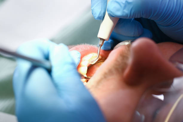 Best Walk-In Emergency Dental Services in Brillion, WI